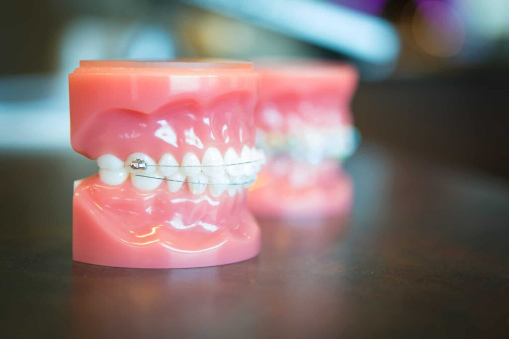 Oltjen Orthodontics - Kansas City Olathe Overland Park Orthodontist-30 Oltjen-Orthodontics-Kansas-City-Olathe-Overland-Park-Orthodontist-30-2-1024x683 - Braces and Invisalign in Kansas City, Overland Park, Olathe, and Paola, Kansas - Oltjen Orthodontics