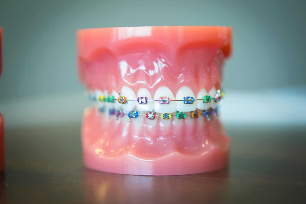 Oltjen Orthodontics - Kansas City Olathe Overland Park Orthodontist-33 Oltjen-Orthodontics-Kansas-City-Olathe-Overland-Park-Orthodontist-33-1024x683 - Braces and Invisalign in Kansas City, Overland Park, Olathe, and Paola, Kansas - Oltjen Orthodontics