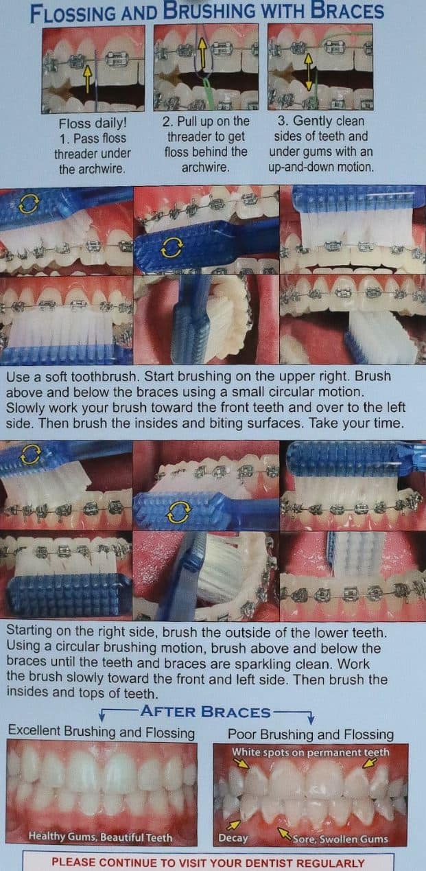Oltjenscreenshot  - Braces and Invisalign in Kansas City, Overland Park, Olathe, and Paola, Kansas - Oltjen Orthodontics