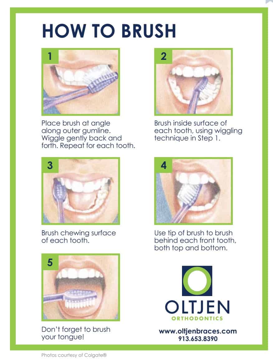 how-to-brush  - Braces and Invisalign in Kansas City, Overland Park, Olathe, and Paola, Kansas - Oltjen Orthodontics