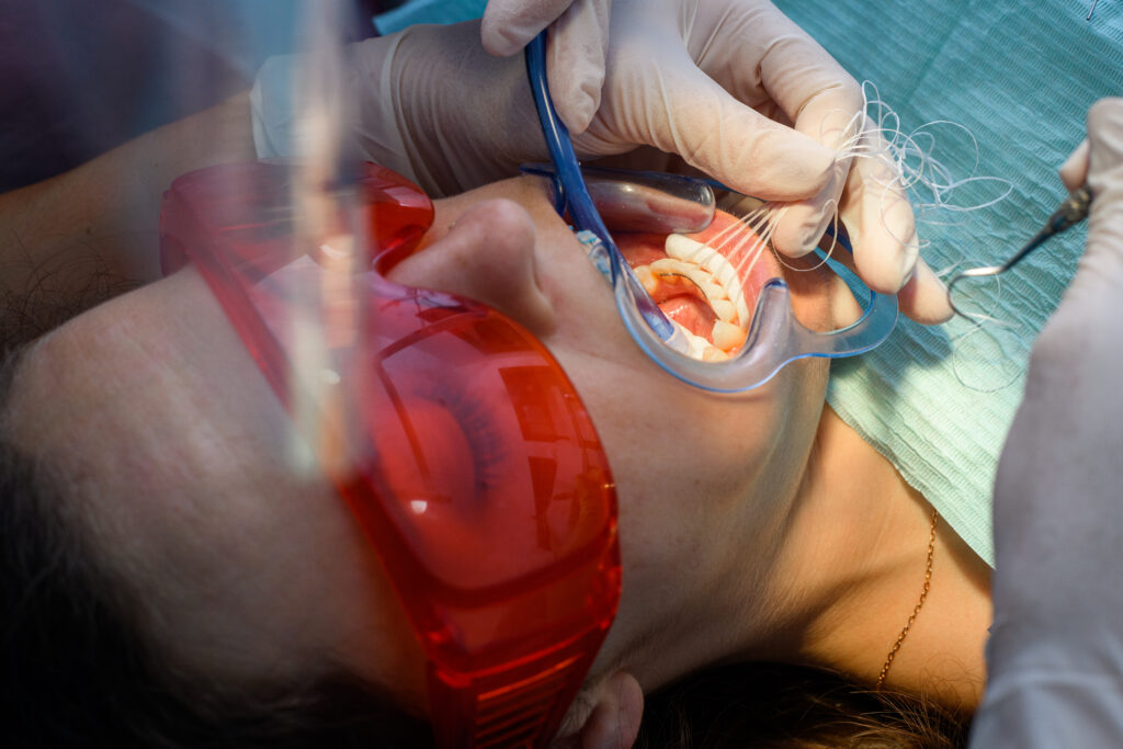 Process of removing dental braces from a Caucasian girl in a dental clinic with a female dentist, placing the fixed retainer process-removing-dental-braces-from-caucasian-girl-dental-clinic-with-female-dentist-placing-fixed-retainer-1024x683 - Braces and Invisalign in Kansas City, Overland Park, Olathe, and Paola, Kansas - Oltjen Orthodontics