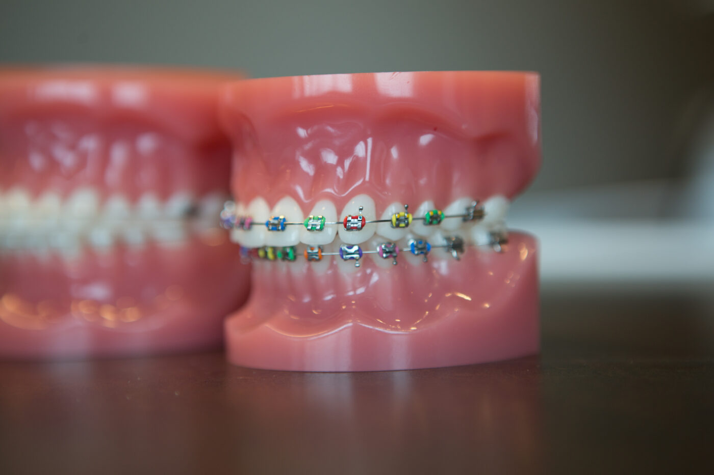 Braces Provider in Olathe & Overland Park